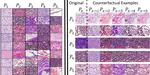 Towards Explaining Image-Based Distribution Shifts