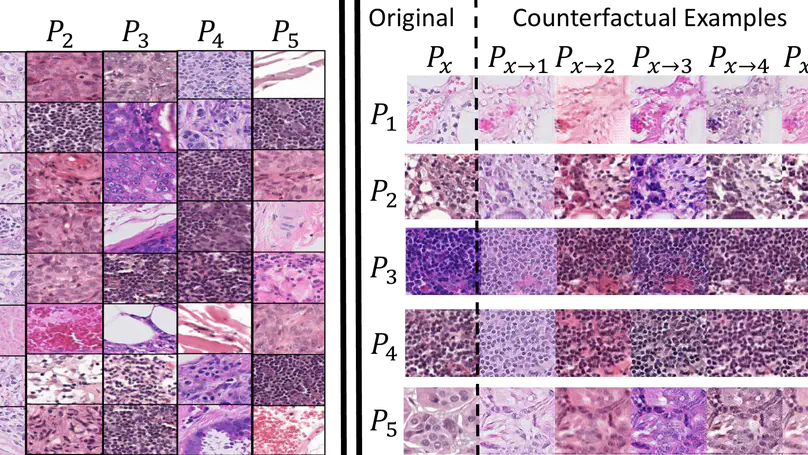 Towards Explaining Image-Based Distribution Shifts